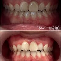 画像1533：施術事例