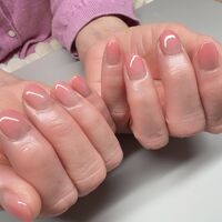 画像1549：施術事例